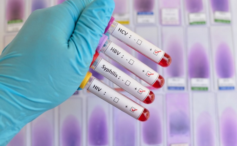 Diagnostic des infections vaginales au laboratoire de biologie médicale